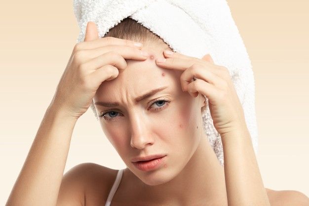 Scalp Acne Treatment