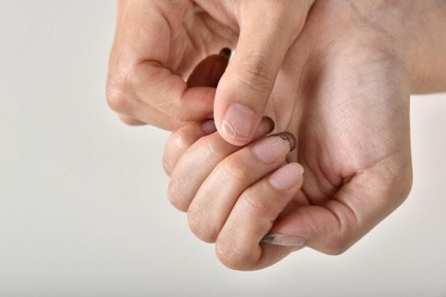 Tips for chapped nails