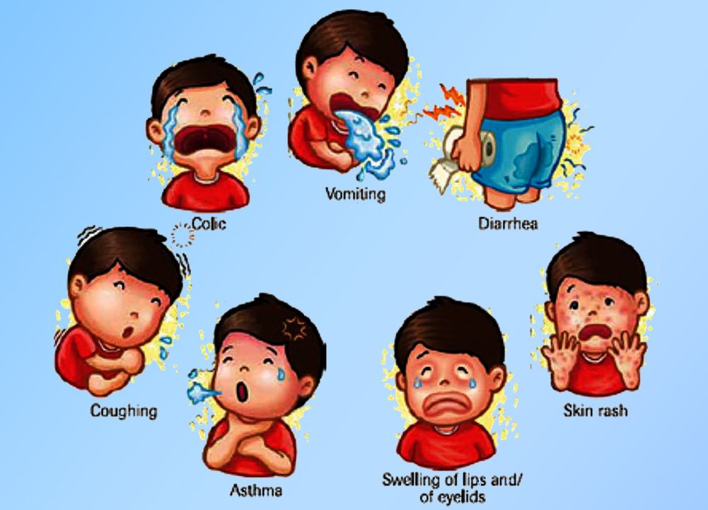 symptoms of food allergy